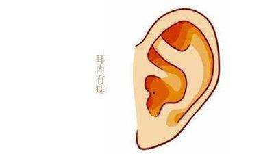 耳朵背后长痣面相图解 耳朵背后长痣财运好