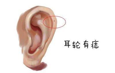 耳朵长痣代表什么图解 耳朵上有痣好吗