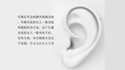 耳朵长痣看吉凶 教你看耳朵长痣的好与坏
