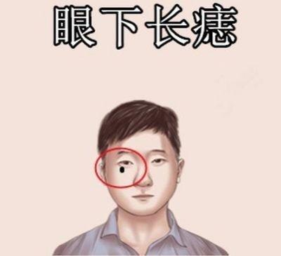 脸上有痣的男人命运图解 男人脸上长痣会怎样