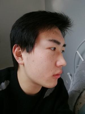 脸上痣多的人会命不好吗 脸上多痣是什么意思