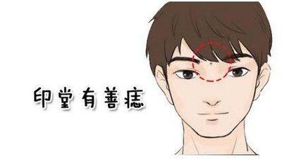 脸上痣的位置与命运 哪些痣相说明命运不好