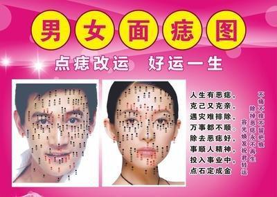 脸上痣的位置影响运势 什么地方长痣不好 脸上痣的位置影响运势 什么地方长痣不好