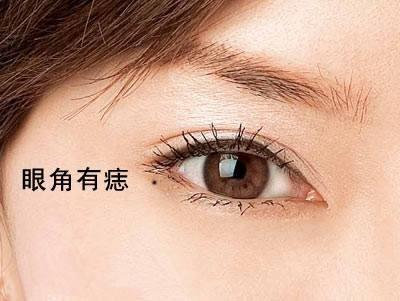 脸上的痣代表什么意思 脸上长痣好吗