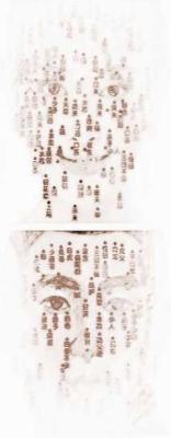 脸上长痣面相图(脸部痣相图解大全女)