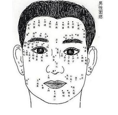 脸上长痣面相怎么样 脸上长痣好不好