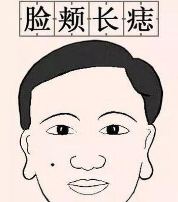 脸上面部痣的位置与命运图解 脸上长痣意味着什么