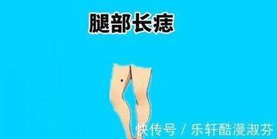 腿部长痣图解 腿部什么位置长痣最不好