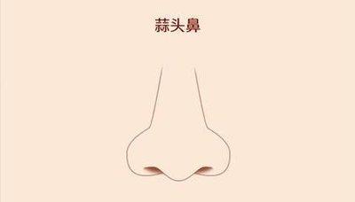 蒜头鼻子女人的面相怎么解释 蒜头鼻的女人命好吗