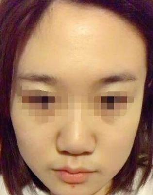 蒜头鼻子的女人的面相 女人长蒜头鼻好吗