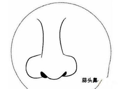 蒜头鼻子的女人的面相如何 女人有蒜头鼻有影响吗