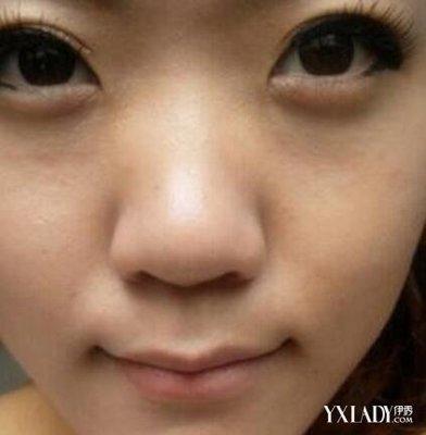 蒜头鼻的人面相好不好 长有蒜头鼻是什么意思