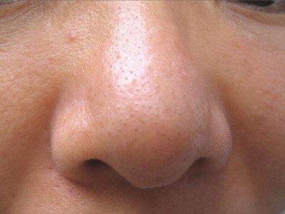 蒜头鼻的女人面相好吗 女人有蒜头鼻意味着什么
