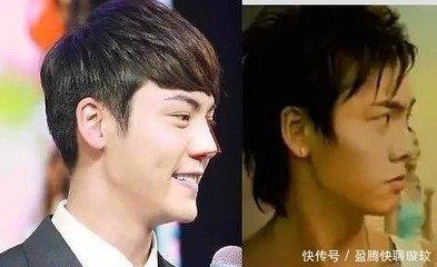 蒜头鼻面相好不好 长有蒜头鼻说明什么