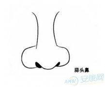 蒜头鼻面相的人好不好 蒜头鼻面相意味着什么 蒜头鼻面相的人好不好 蒜头鼻面相意味着什么