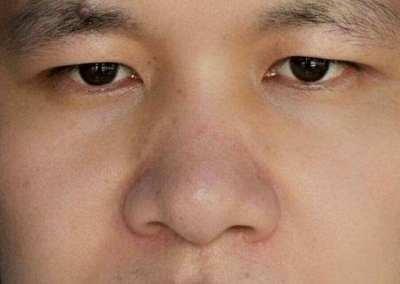 蒜头鼻面相解析 有什么样的命运面相解析