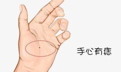 解读男人手心有痣好吗 男人手掌心长痣意味着什么