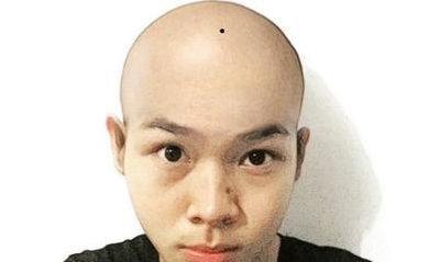 解读痣长在哪里事业运好事业顺风顺水