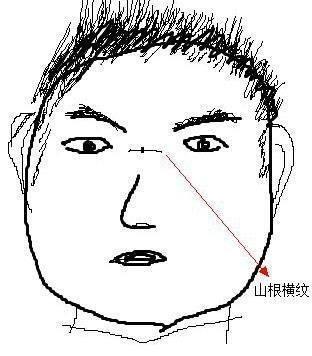 解析山根有横纹的人命好吗 山根有横纹意味着什么