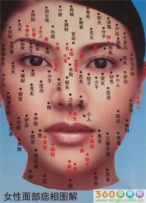 解析男人脸上的三大痣相 男人脸上哪里长痣好