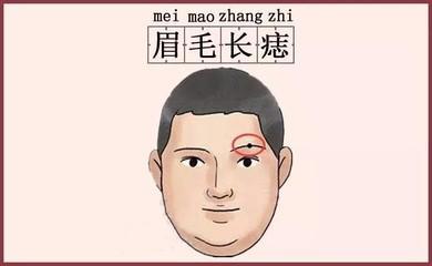 解析男人脸上的三大痣相 男人脸上哪里长痣好