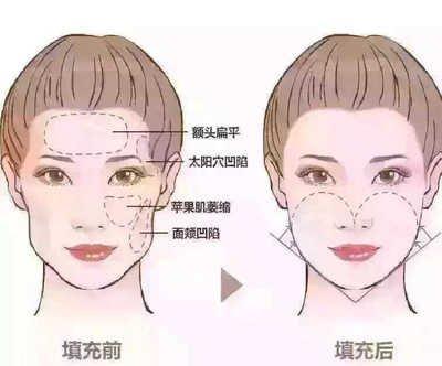 论额头窄面相命运好不好 额头窄的人一生运势