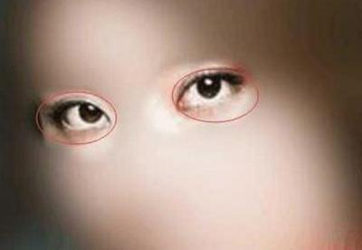 详解女人三白眼面相运势好吗 女人长三白眼好不好