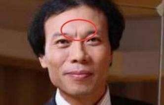 详解悬针纹面相图解 长有悬针纹好吗 详解悬针纹面相图解 长有悬针纹好吗