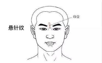 详解悬针纹面相图解 长有悬针纹好吗