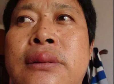 贫穷男人的面相有三种有其中一种都不好
