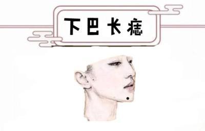 身上最有福气的3处吉痣 身上哪些地方长痣好