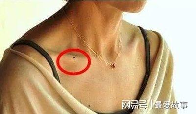 身上有中3种痣相是吉兆 身上这三个地方长痣好