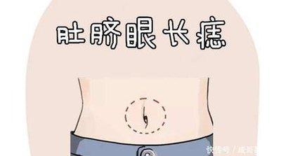 身体上最有福气的痣 身上这些地方长痣好