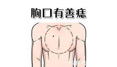 身体各部位痣的含义 身上长有痣好吗