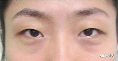 通过眼睛看命运如何 命运好的人眼睛具有什么特征