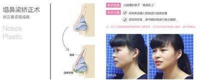 长朝天鼻的女人好不好 女人有朝天鼻说明了什么