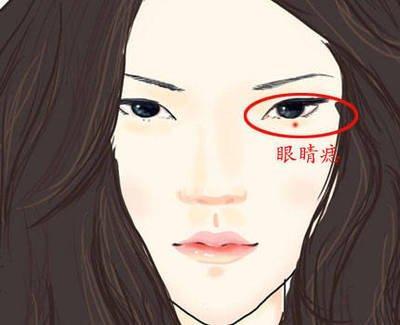 面相中的三大旺夫痣 女人哪些地方长痣好