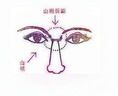 面相为你解析鼻梁中间有横纹说明什么