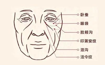 面相之三种常见的法令纹面相 法令纹面相怎么看