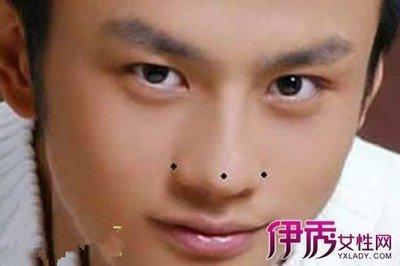 面相五官之鼻翼过薄者一生难财运不佳吗