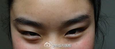 面相分析丹凤眼的人命运 长有丹凤眼好吗