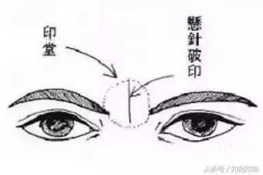 面相分析额头有悬针纹的人 额头有悬针纹的人命好吗