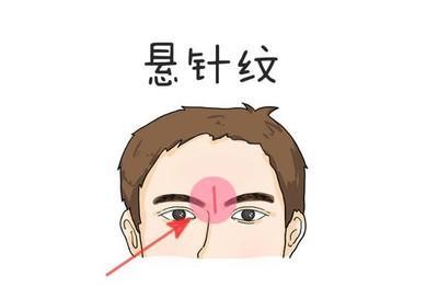 面相分析额头有悬针纹的人 额头长有悬针纹好不好