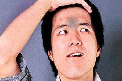 面相印堂发黑是什么征兆 印堂发黑面相到底好不好