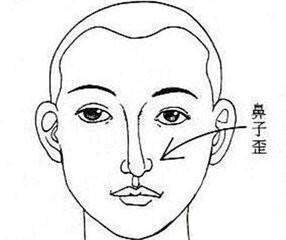 面相嘴歪有福气么 嘴歪的女人面相分析命运