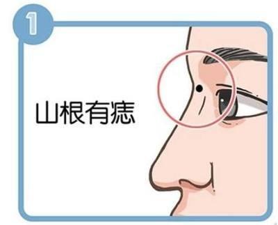 面相学之痣相大全 怎样看出痣是好还是坏