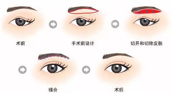 面相学之通过眉毛看人的性格和命运好坏