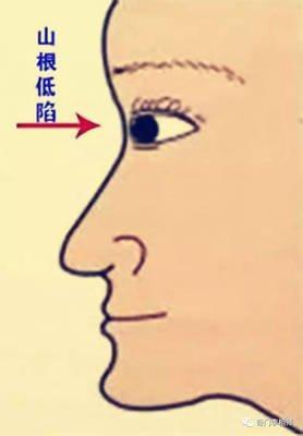 面相山根低的人运势是什么样 山根低面相好吗