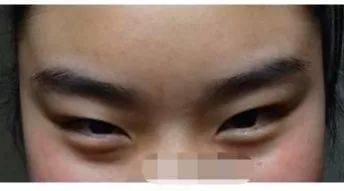 面相解析丹凤眼是什么意思 长有丹凤眼意味着什么