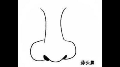 面相解析蒜头鼻 蒜头鼻面相说明了什么